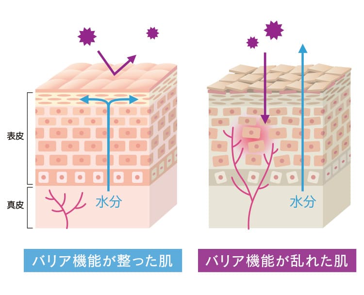 原因はバリア機能が整っていないこと