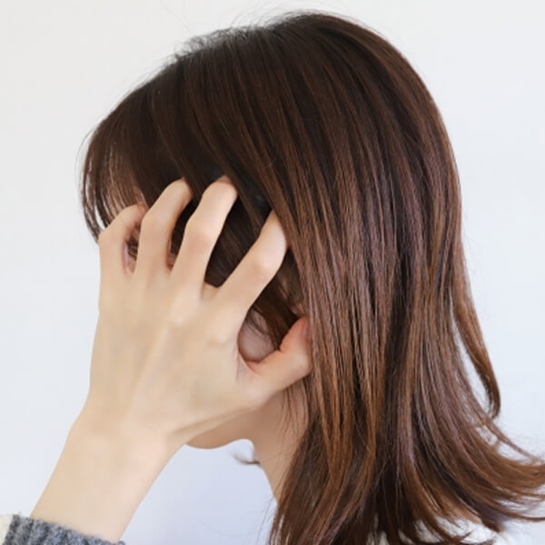 頭皮の不安
