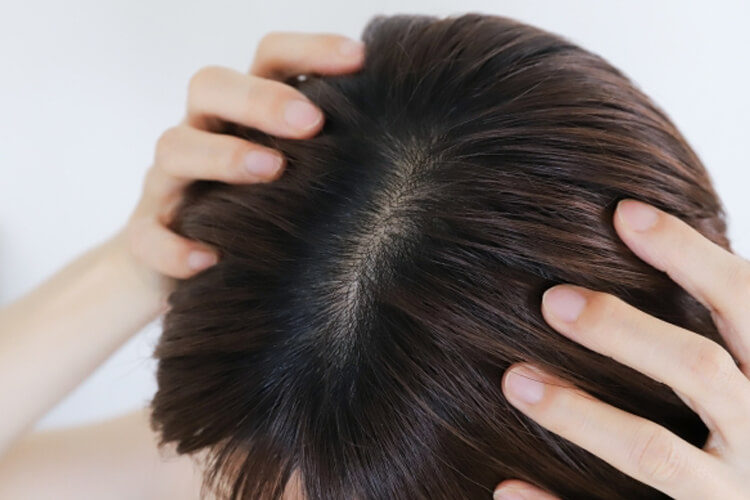 シャンプー やさしい洗浄 くりかえすトラブルを防ぐ