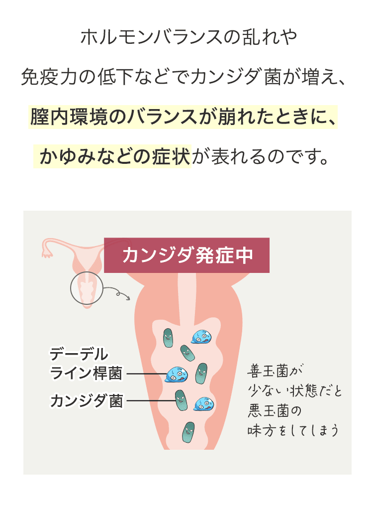 善玉菌が少ないとかゆみなどが起こってしまう