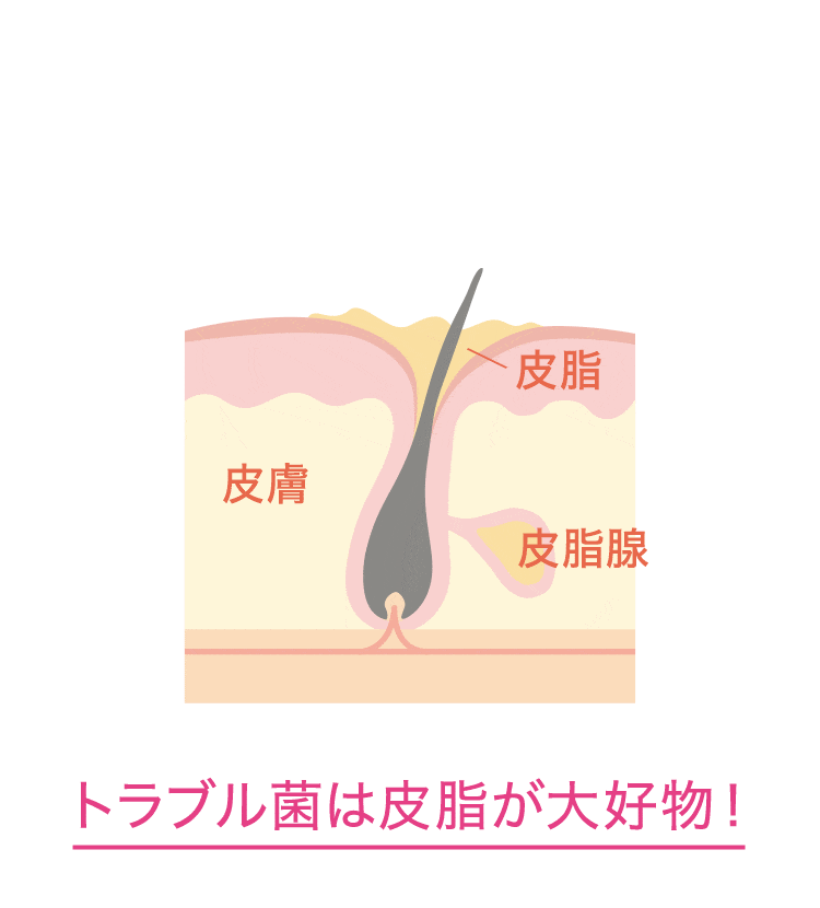 皮脂分泌が多いとトラブル菌が増殖！