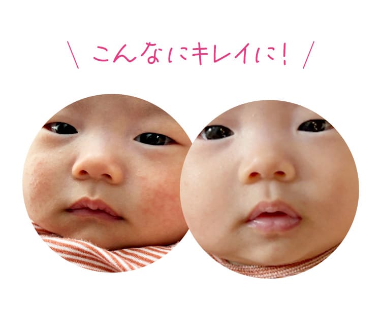 常在菌ケアですべすべお肌に♡