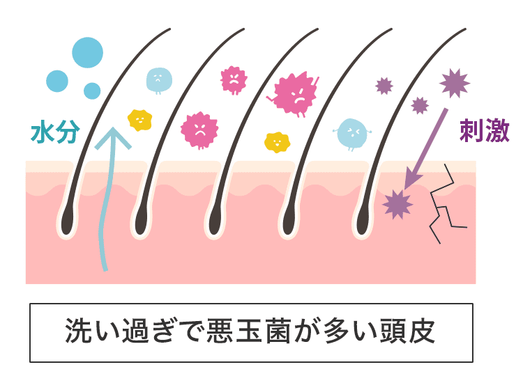 洗いすぎると常在菌バランスが整わず、頭皮環境が悪化してしまう