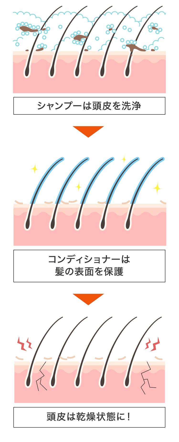 シャンプーでは頭皮の乾燥やフケは解消できない