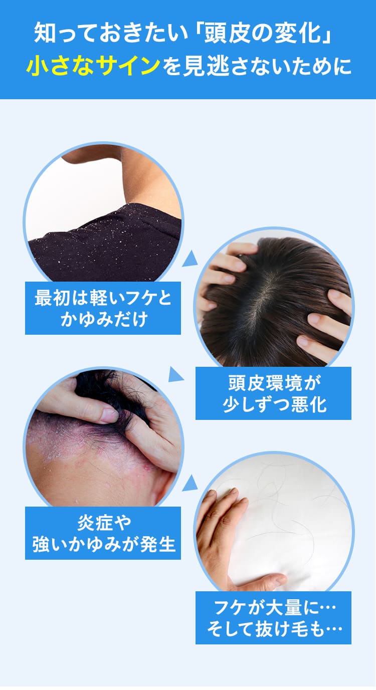 知っておきたい「頭皮の変化」—小さなサインを見逃さないために
