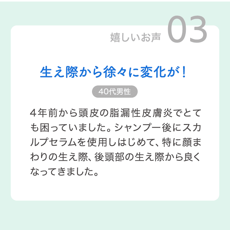 生え際から徐々に変化が！