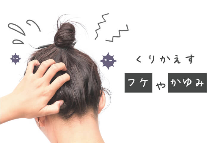 くりかえすフケやかゆみ