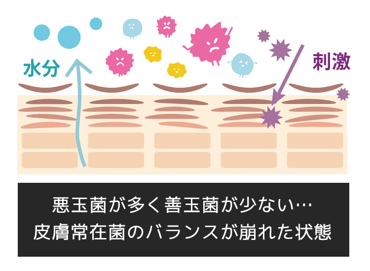 皮膚常在菌のバランスが崩れた頭皮